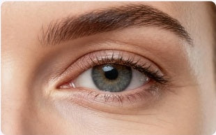 Under-eye comparison 1, after use