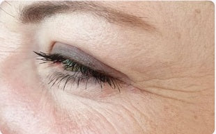 Under-eye comparison 2, before use